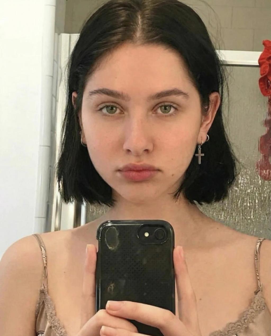 Remove Dark Circles & Under-Eye Bags AI generated image example